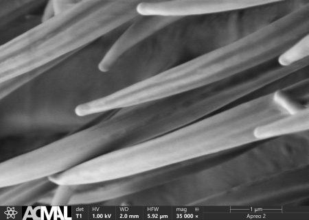 A microscopic image of fly hair