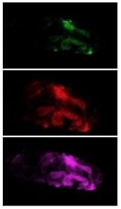 Changes in pH cause the rhodol dyes to glow differently, offering insight into diseases that affect mitophagy. Three slides each with a different color of rhodol dye